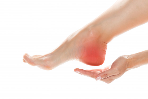 Heel spurs with plantar fasciitis, a cause of heel pain: Symptoms and  treatment