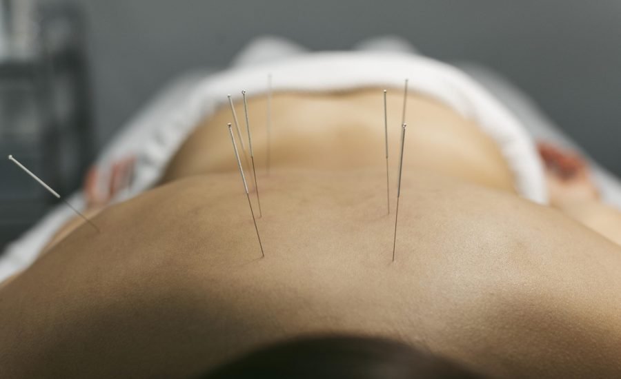 acupuncture-process-client